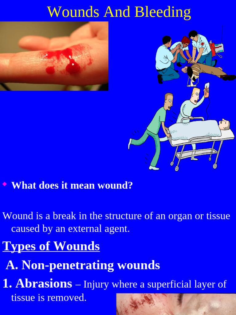 Types and First Aid for Wounds | PDF | Wound | Amputation