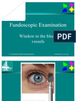 Fundoscopic Examination