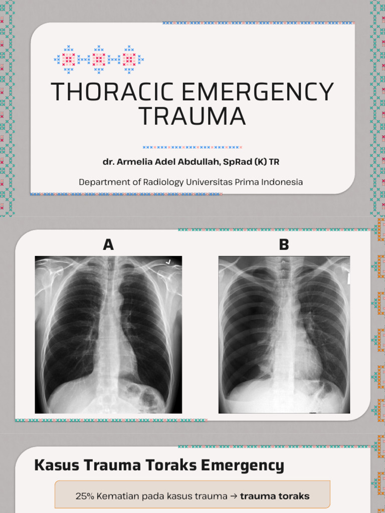 Thoracic Emergency Trauma | PDF