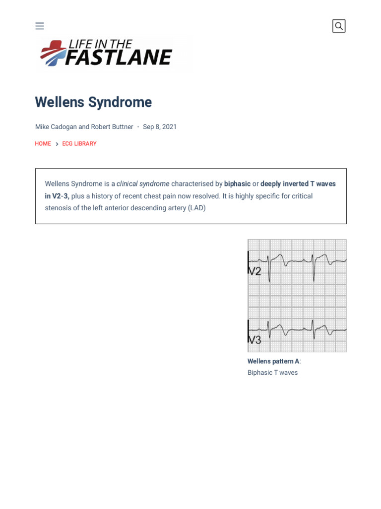Wellens Syndrome: ECG Patterns & Diagnosis | PDF | Electrocardiography ...