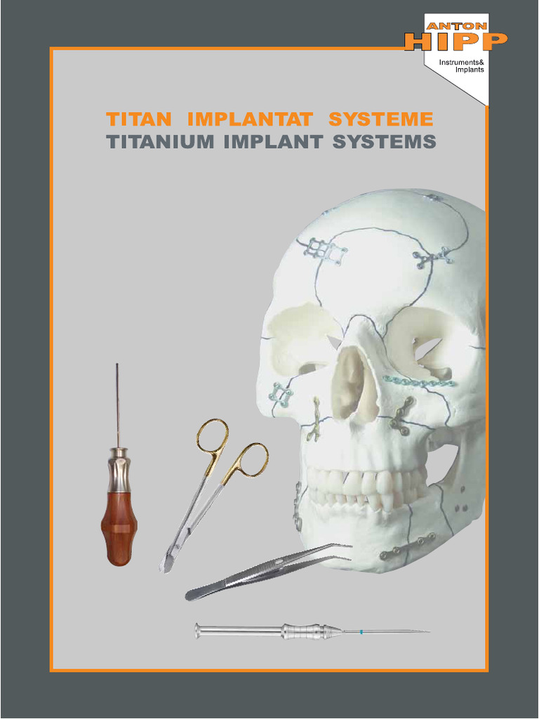 Titanium Implant Systems | PDF