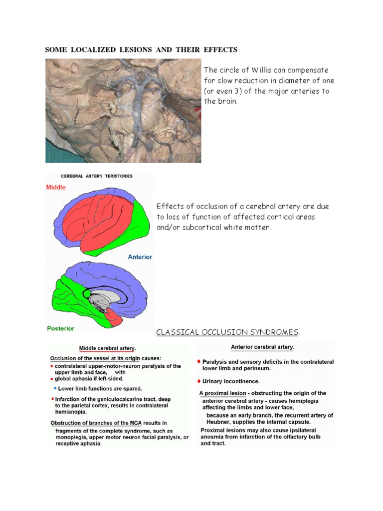 Localized Brain Lesions and Effects | PDF | Wellness | History