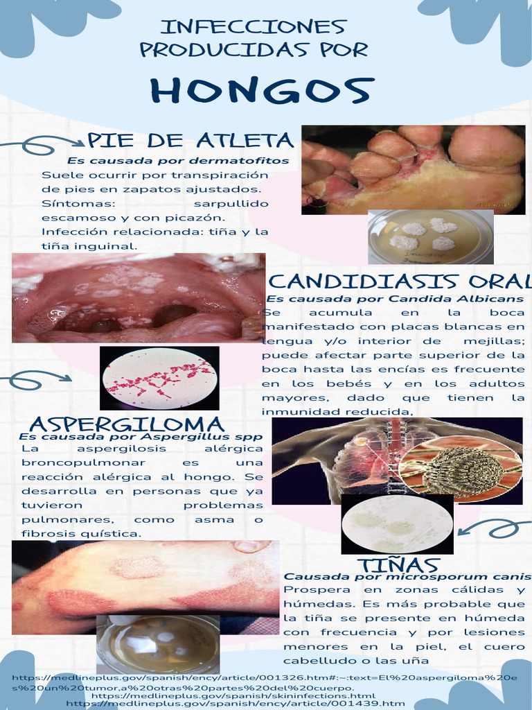 Infecciones Producidas Por | PDF