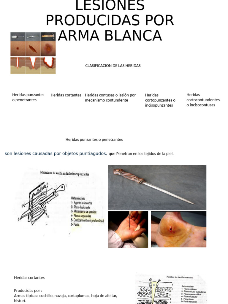 Tipos de Heridas por Arma Blanca | PDF