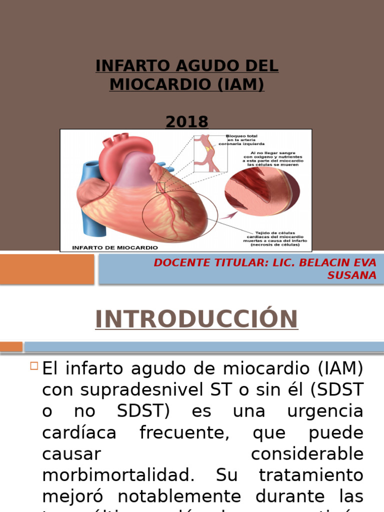 Tratamiento del Infarto Agudo de Miocardio | PDF | Infarto de miocardio ...
