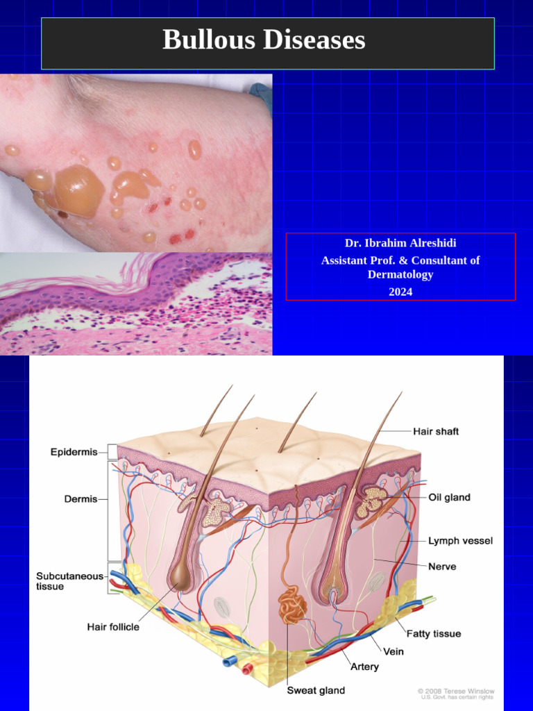 Bullous Diseases 2024 | PDF | Immunology | Cutaneous Conditions