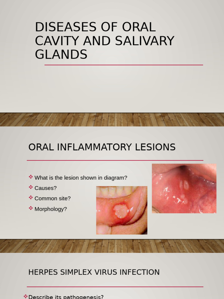 Diseases of Oral Cavity and Salivary Gland | PDF