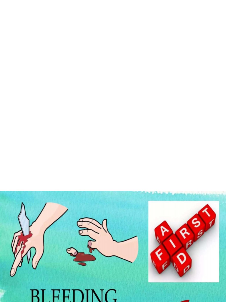 First Aid of Bleeding | PDF