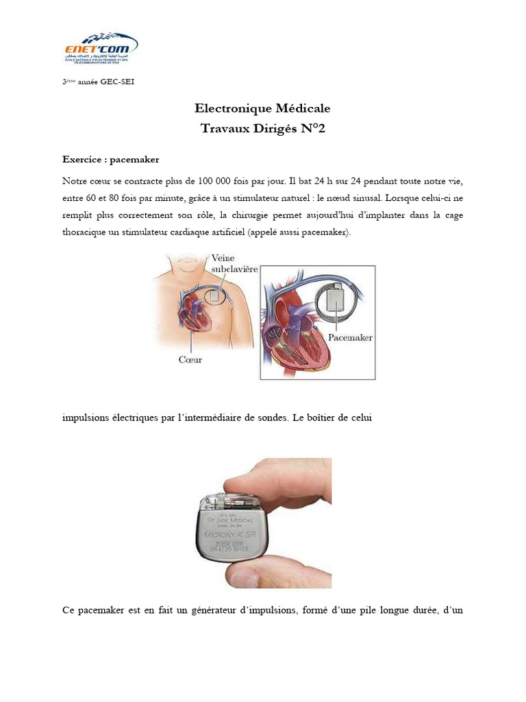 Fonctionnement du Pacemaker Cardiaque | PDF | Stimulateur cardiaque ...