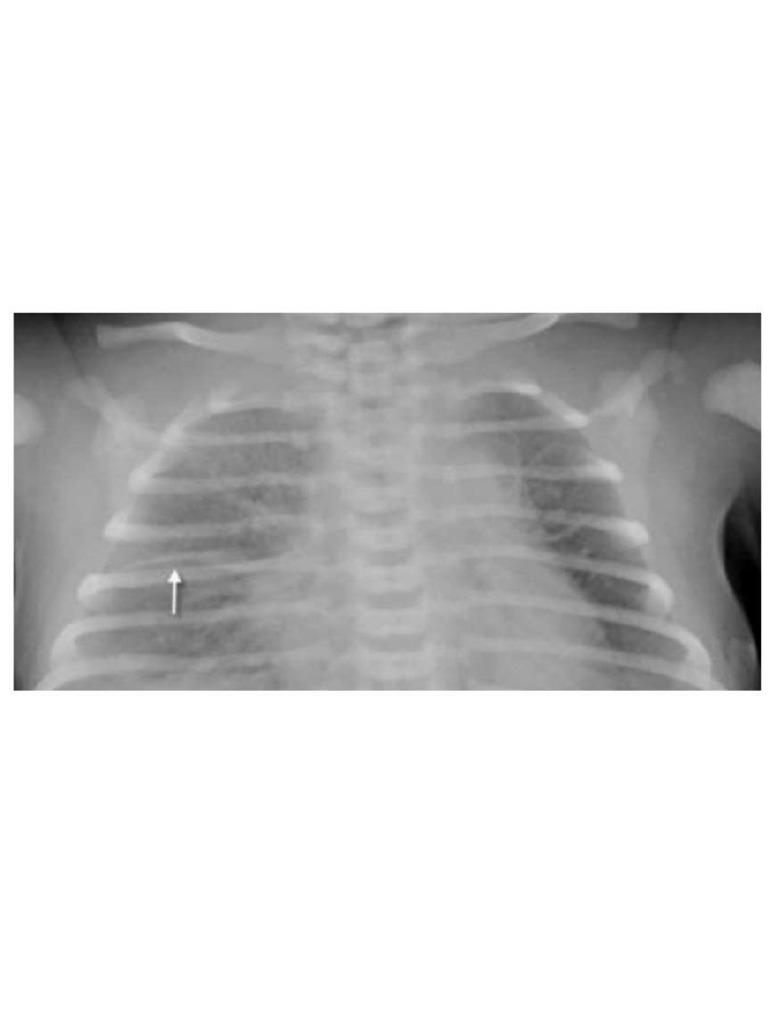 Medicine Pediatric Radiology Integration | PDF