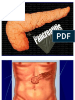 pancreatitis