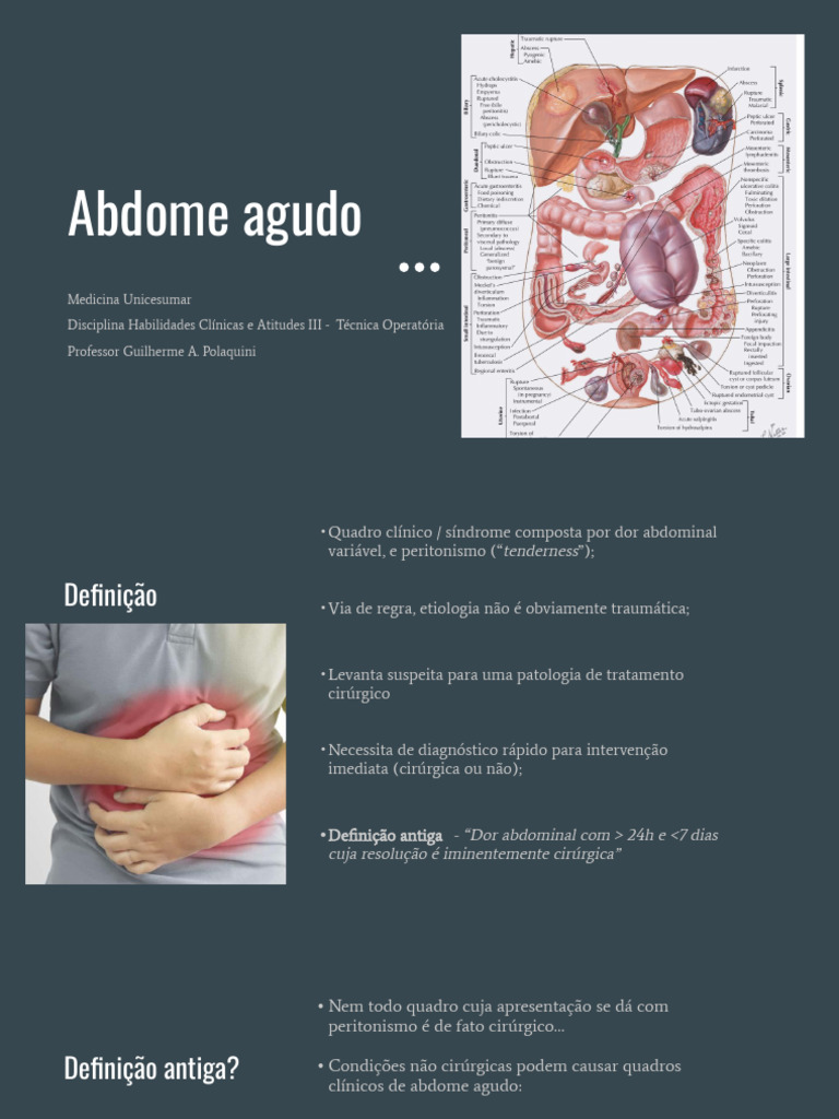 Diagnóstico e Manejo do Abdome Agudo | PDF