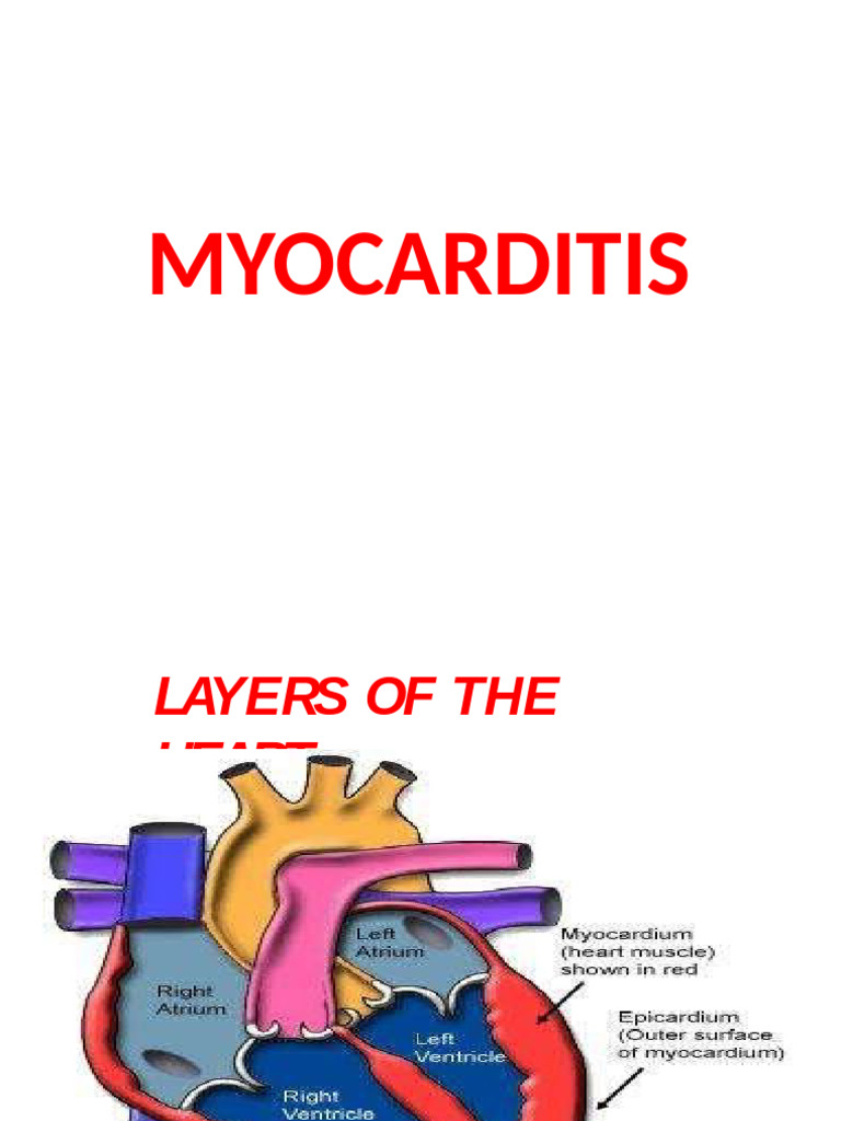 myocarditis-pdf-heart-infection