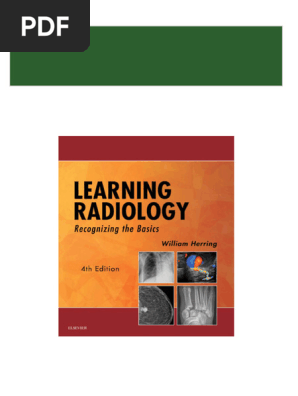 Download Complete Learning Radiology Recognizing the Basics