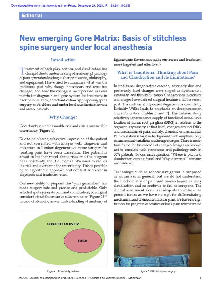 Stitchless Spine Surgery Under Local Anesthesia | PDF | Back Pain | Surgery