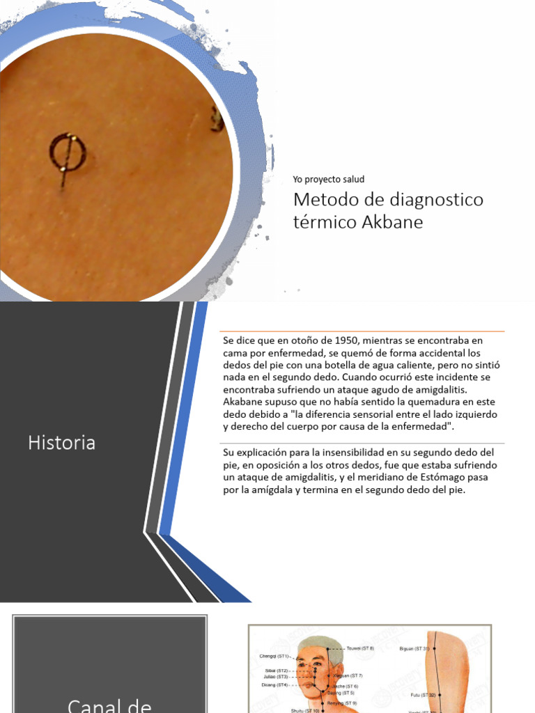 Diagnóstico Térmico Akabane: Método Efectivo | PDF | Acupuntura ...