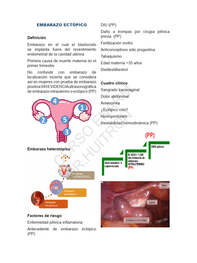 04-EMBARAZO_ECTOPICO | PDF | El embarazo | Especialidades Medicas