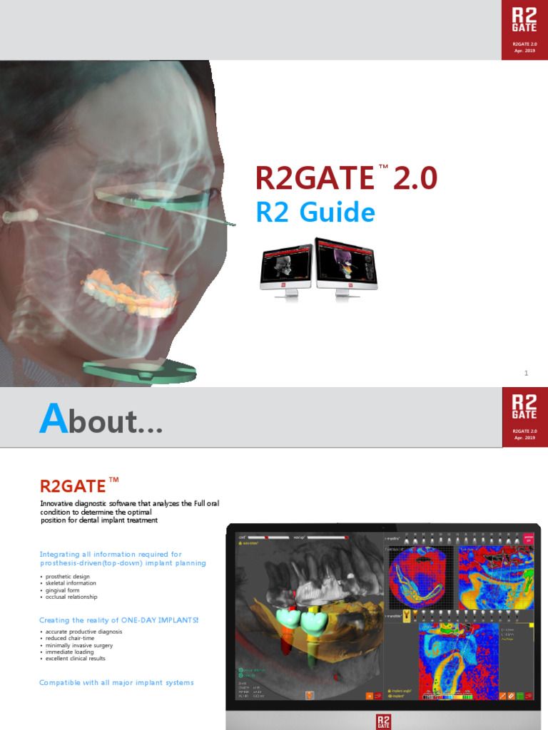 4 2 R2GATE 2.0 Manual For GuideEN 2 | PDF | Dental Implant | Microsoft ...