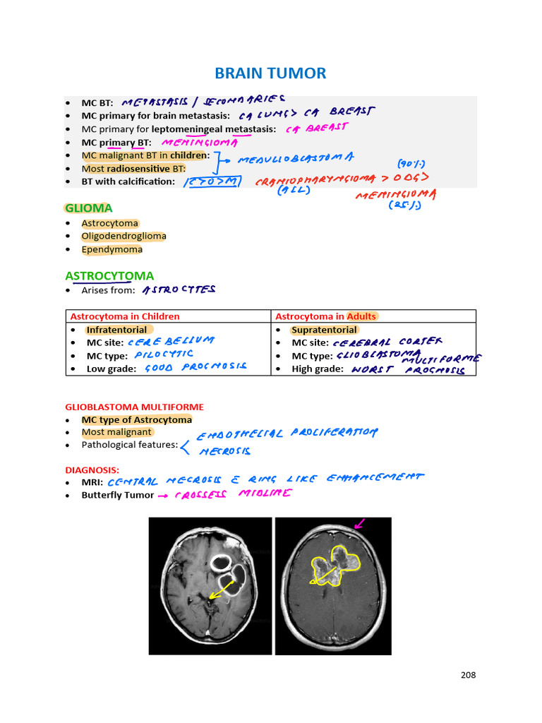 7 Head Neck 2 Pdf Brain Tumor Metastasis