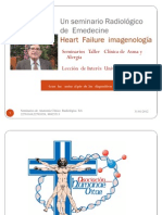 Insuficiencia Cardíaca, Inotrópico, Lusitrópico, Patrones Radiologicos Reconocibles en Una Radiografia Standard.