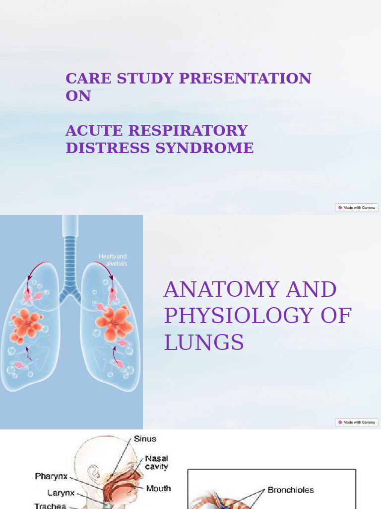 Acute Respiratory Distress Syndrome ARDS - PPTX NEW | PDF | Lung ...