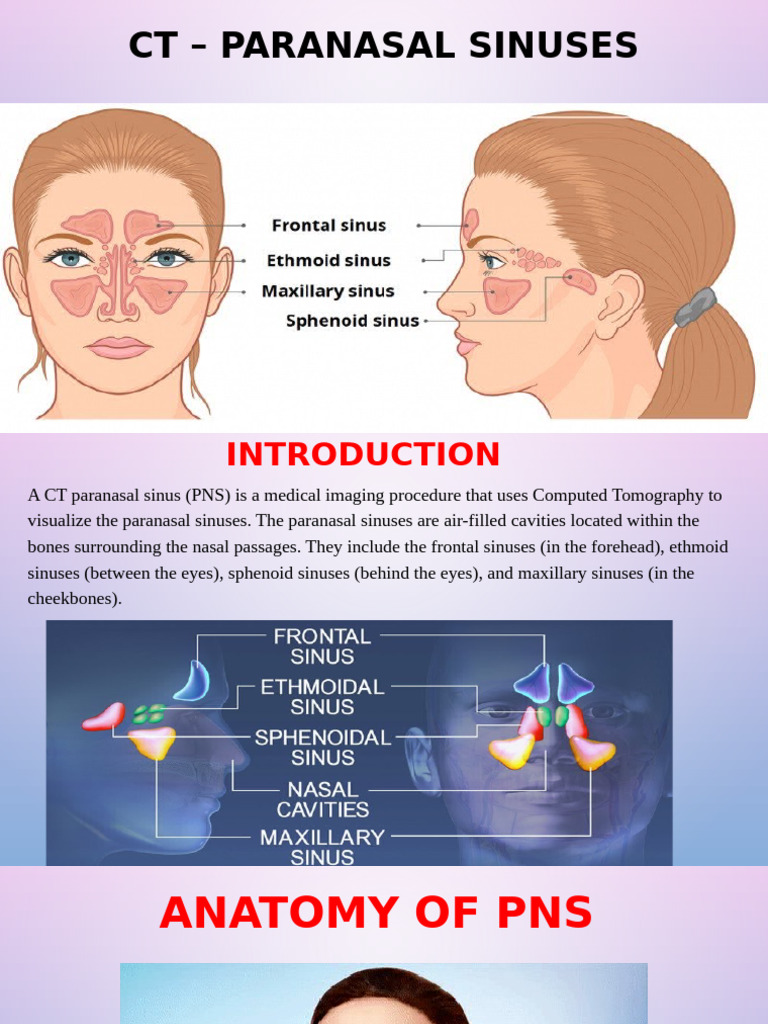 CT Imaging of Paranasal Sinuses | PDF | Human Nose | Surgical Specialties