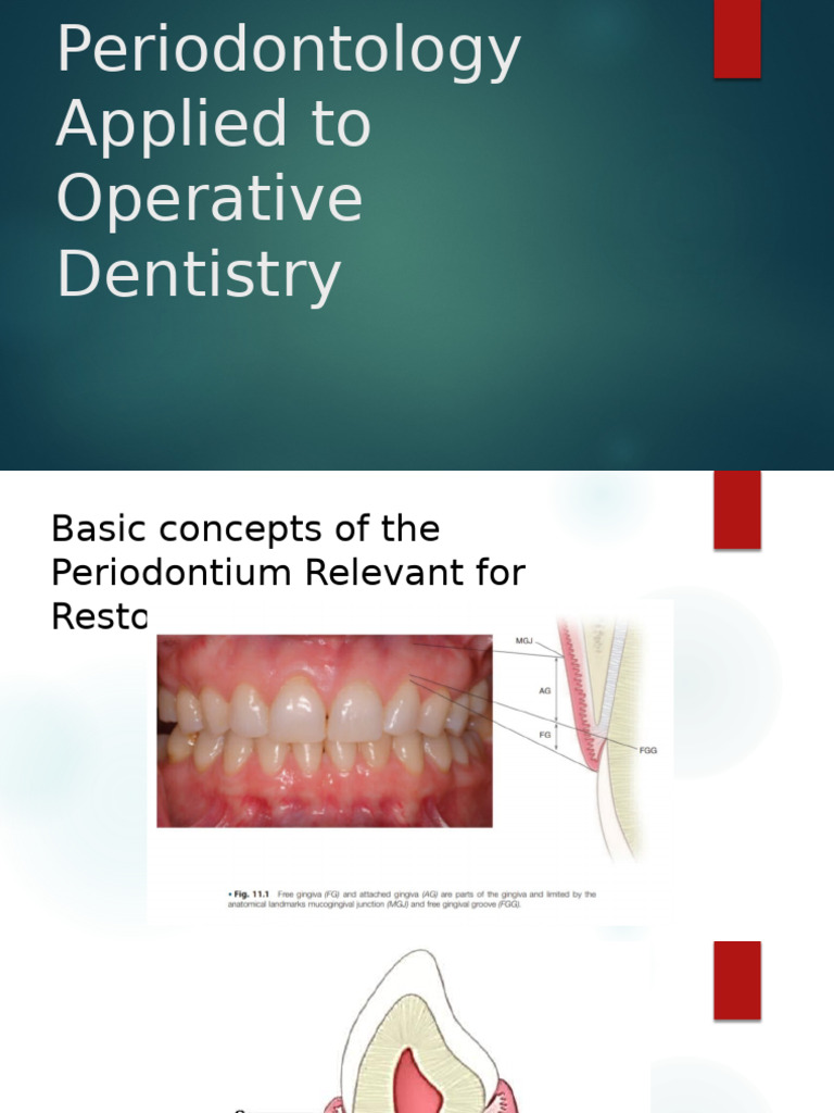 Palato Radicular Groove Overview | PDF | Periodontology | Dentistry