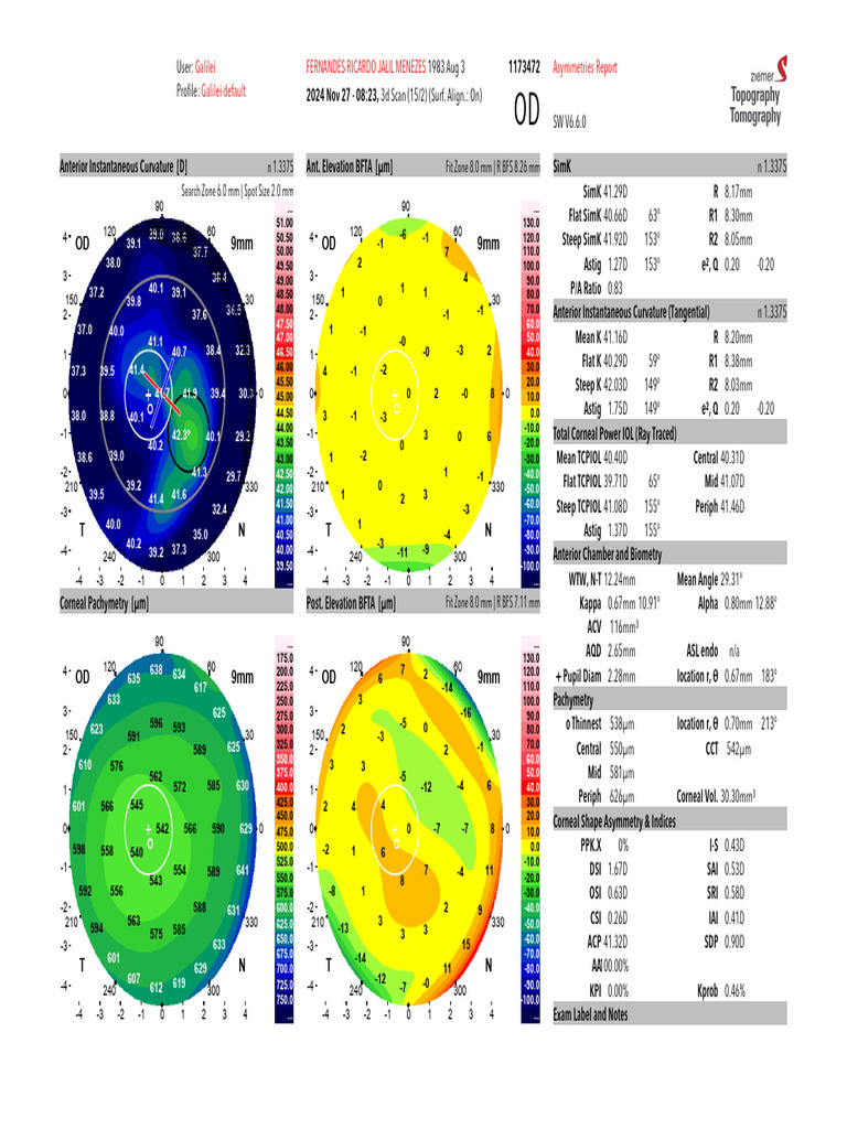 Galilei 3D Scan Analysis Report | PDF | Ophthalmology | Human Eye