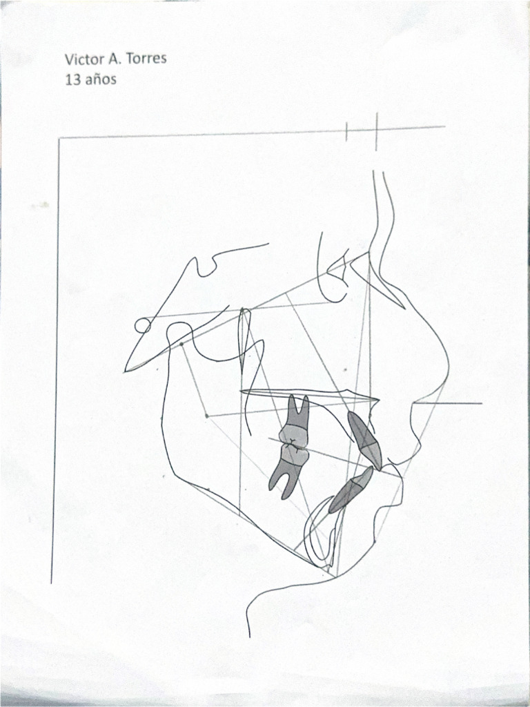 Ricketts Luis Alvarez 1 | PDF
