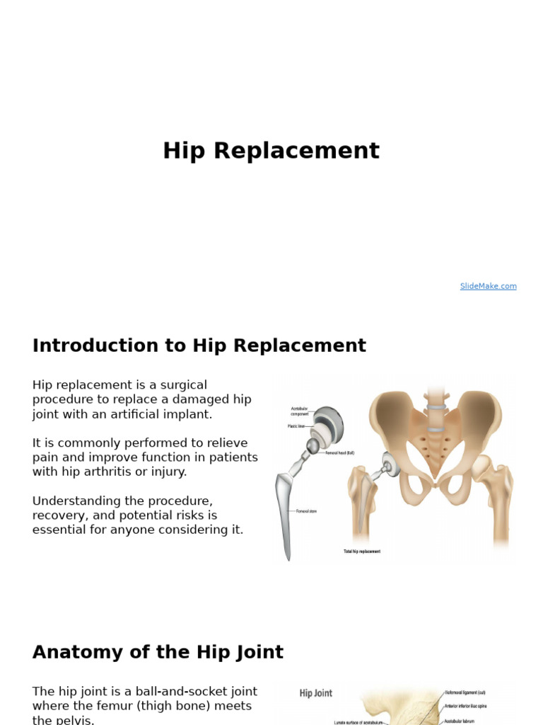 Hip Replacement | PDF | Surgery | Hip