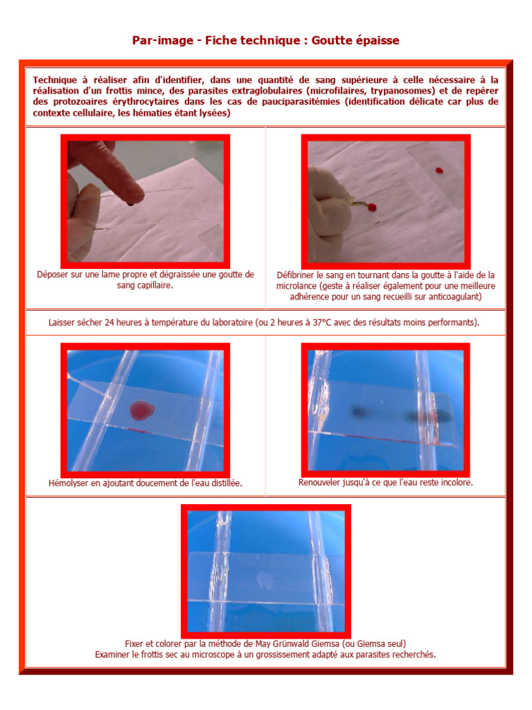 technique-de-goutte-paisse-en-microscopie-pdf
