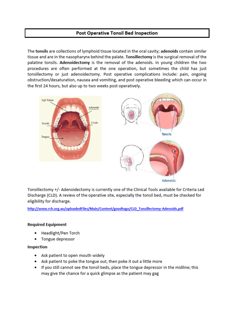 Screen Replacement Frunsi T8 Drawing Tablet X14 Largest Standalone Drawing Tablet U2022 PicassoTab U2022 No Computer Needed U2022 Pro Drawing Apps & Tutorials U2022 14 Inch Screen U2022 Stylus Pen U2022 Portable