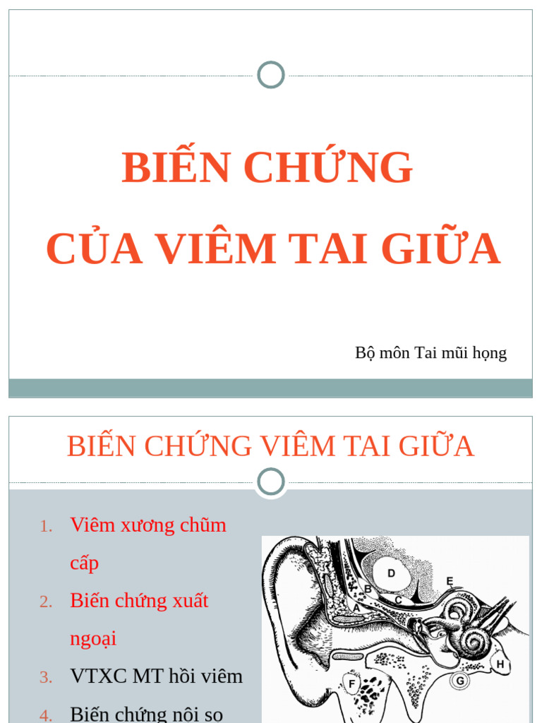 Bien Chung Viem Tai Giua | PDF