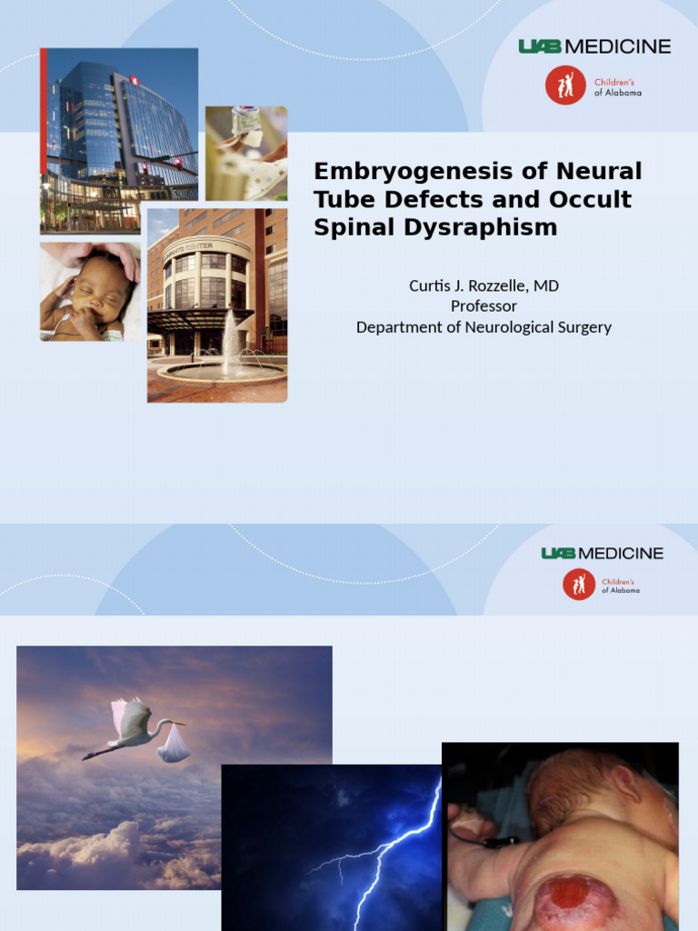 Embryogenesis of Neural Tube Defects and Occult Spinal | PDF | Clinical ...