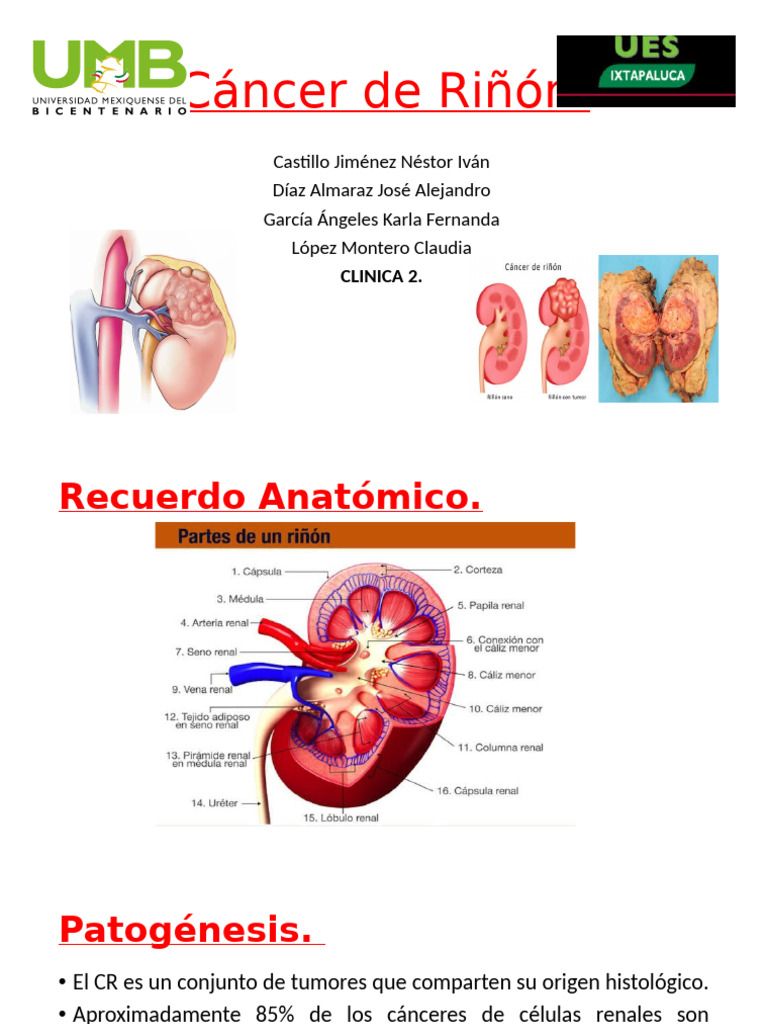 Cáncer de Riñón: Epidemiología y Tratamiento | PDF | Cáncer | Metástasis