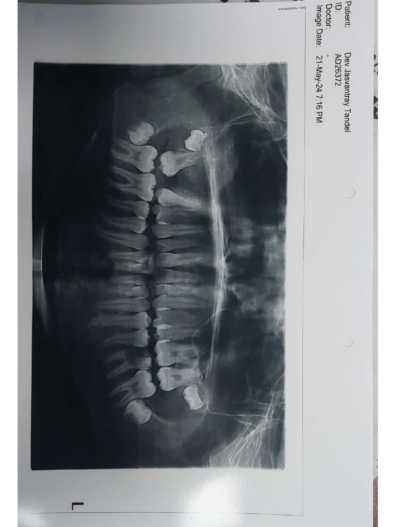X Ray | PDF