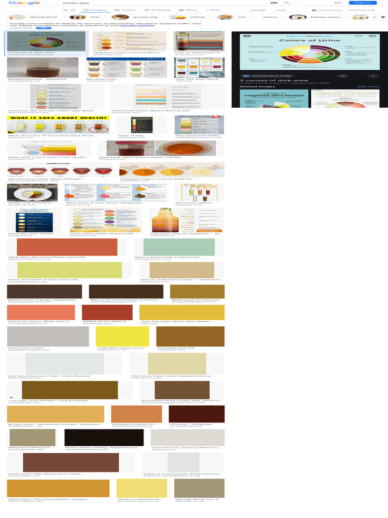 Screenshot 2021-02-19 at 12.12.41 PM | PDF | Urine | Urinary Tract ...