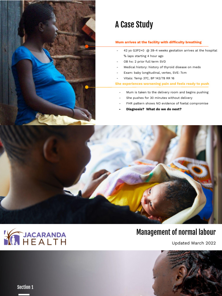 Management of Normal Labour | PDF | Childbirth | Pregnancy