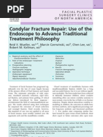Download Condylar Fracture by Archies Pagar SN80249568 doc pdf