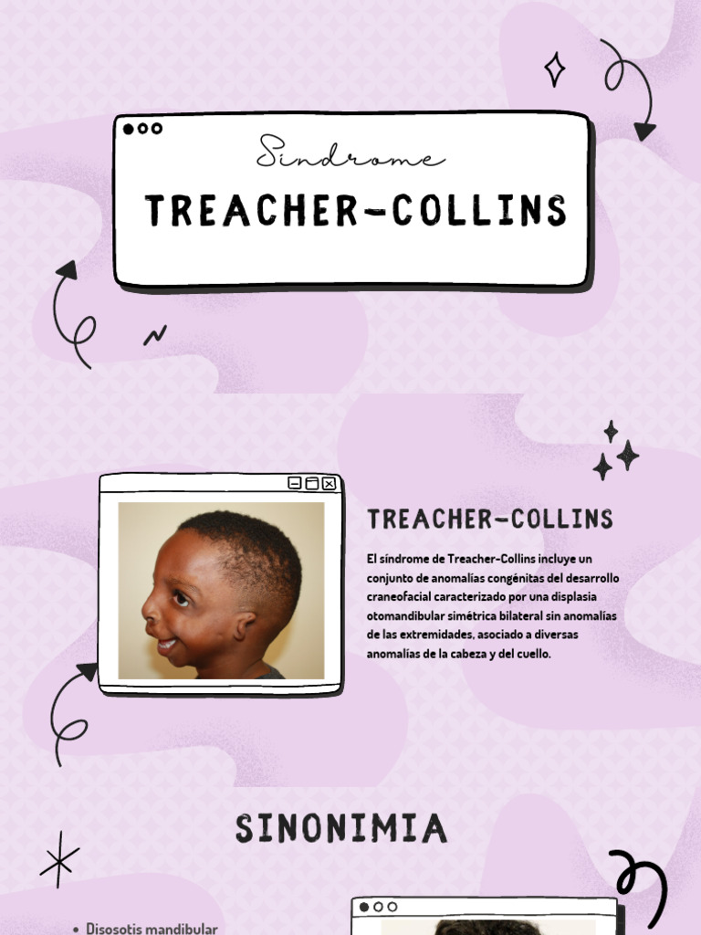Treacher - Collins | PDF | Escuchando | Enfermedades y trastornos