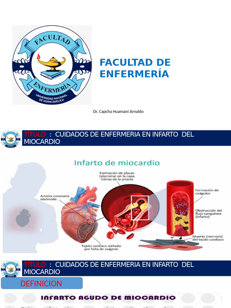 Cuidados de Enfermeria en Infarto Agudo Del Miocardio | PDF
