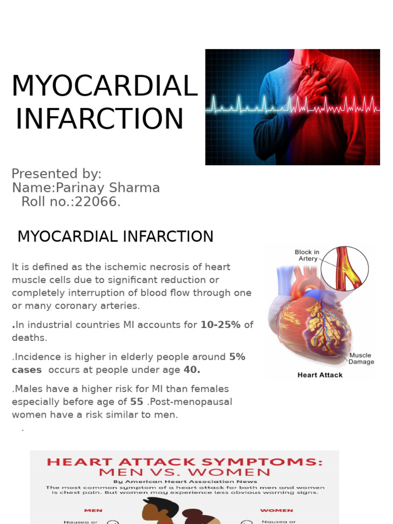 Myocardial Infarction | PDF | Myocardial Infarction | Heart