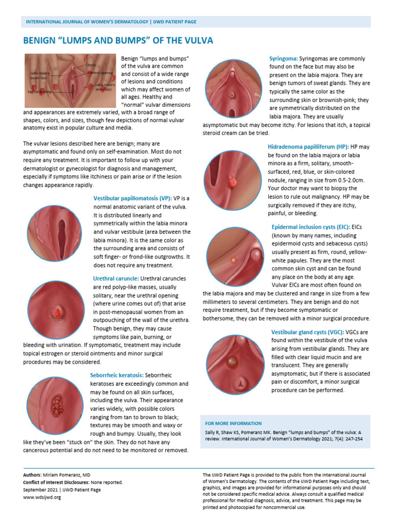The role of magnetic resonance imaging in the rare pathologies of the vulva  - European Journal of Radiology, image size:768x1024
