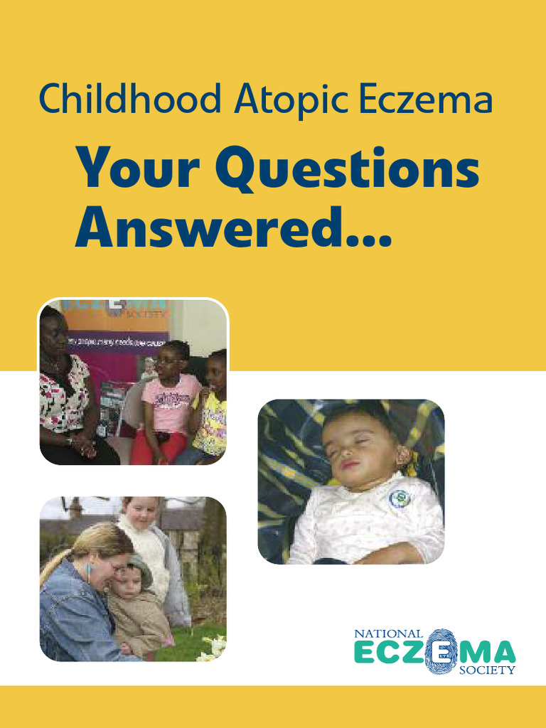 Childhood Atopic Eczema Booklet 2023 | PDF | Dermatitis | Topical ...