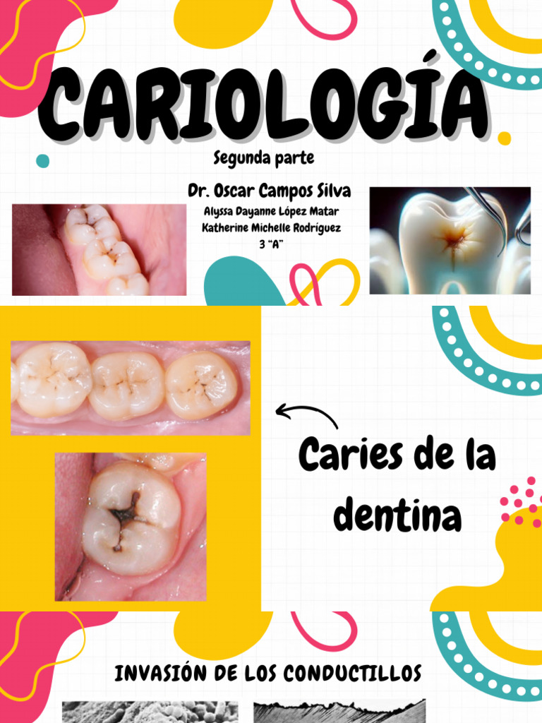 Cariología 2da Parte) | PDF
