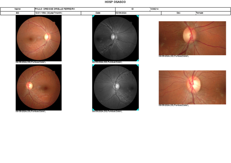 Fundus Exam Report for Paulo Dreisse | PDF