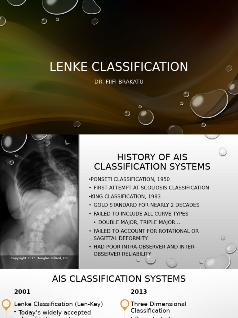 Overview of Lenke Classification System | PDF | Vertebral Column ...