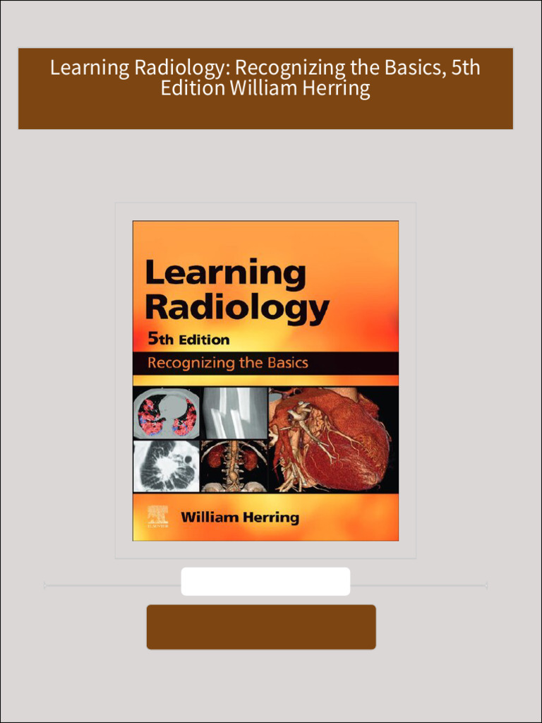 Learning Radiology: Recognizing the Basics: William Herring
