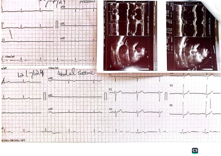 ECG Report Central Hospital | PDF
