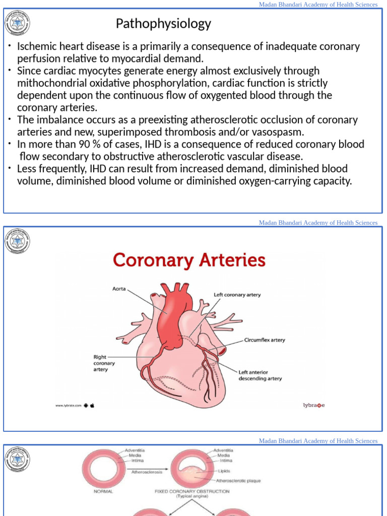 Ischemic Heart Disease | PDF
